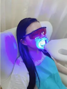 ✨短時間で手早く♪ため込んだ黄ばみ解消✨8回照射×8分セルフホワイトニング