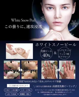 ホワイトスノーピール1回5000円