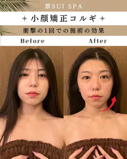 【人気NO.1🥇小顔&たるみ改善】 頭蓋骨矯正+小顔矯正コルギ(首肩/デコルテ/二の腕オイルマッサージ付き)