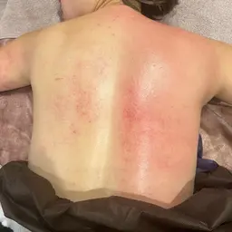 ご新規様😊温活♨️凝り固まったお背中のデトックス➕天使の羽🪽ケア