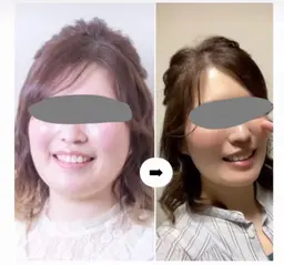 3名限定🫧初回無料体験/3ヶ月〜モニター/ダイエット美容整体