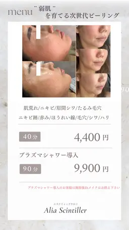 お肌揺らぎやすい方、赤み出やすい方必見！！次世代型ピーリングトリートメント👼