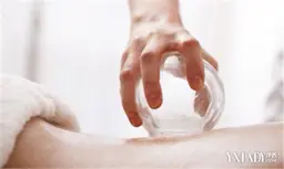 スライドカッピング