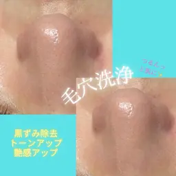 当日予約限定《人気の毛穴洗浄》透明感爆誕！！✨毛穴の汚れが溜まりやすいTゾーン¥4400→¥3000