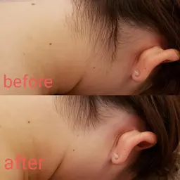 ☆全身脱毛が¥8,250でできるクーポンメニュー☆　３ヶ月以上ご来店ないかた