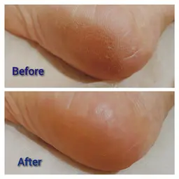 【まつげパーマと足裏ケア】角質除去&足つぼマッサージ&角質柔らかくするクリーム仕上げ☆同時施術☆¥11000→¥9660