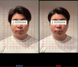 【モニター募集】顔の歪みが気になる方
