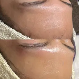 《潤艶全顔wax》ムダ毛を取り除きながら角質ケア🧖🏻‍♀️💎✨肌タイプに合わせた肌再生生パック付き💛