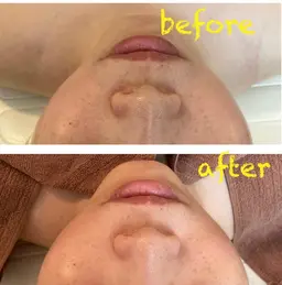 小顔矯正＋保湿フェイシャル＋ドライヘッドマッサージ