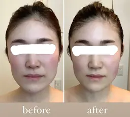 ご新規様様or半年以上ご来店のないお客様限定！顔骨気(コルギ)　即実感◎（施術時間４５分）