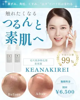 🍓韓国式毛穴洗浄(黒ずみ・毛穴の開きケア)➕毛穴引き締めパック付き✨️