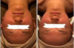 【首を長く、顔は小さく】巻き肩解消×本格オイルコルギ+デコルテ流し(50分)