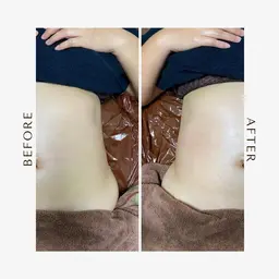 体質改善全身リンパマッサージ:モニター様（ビフォーアフター写真、アンケートにご協力お願いします）