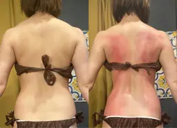 🔥徹底痩せ🔥 1回でも大幅変化‼️サーモシェイプdeepを使ったスペシャルオーダーメイドコース