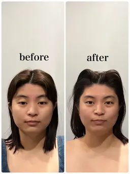 通常小顔施術90min ¥20,900→破格の¥1,000‼️お客様にあったコースもご案内させていただきます！