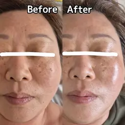 老化肌質改善✨️若い頃の自分に戻れる！