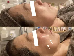 【年齢肌】年齢肌立て直すトータル集中ケアコース