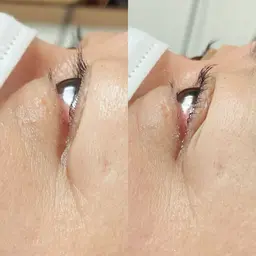 まつげカール（所要時間約40分）