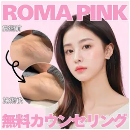 色素沈着・メラニン除去🫧ローマピンク40%OFF【カウセリング相談30分】