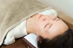 【女性限定】電気を流す美容鍼