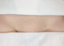 VIOのワックス脱毛。オールオフ/V残してIOオフ、どちらでもOK！