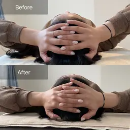 頭蓋骨・小顔矯正（初回）