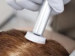 頭皮ケアエステ・ヒト骨髄幹細胞成長因子を使ったトリートメント ※口コミモデル様募集!