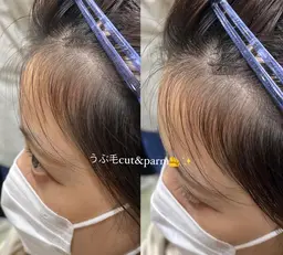 韓国発‼︎産毛パーマ🇰🇷💓チャンモリパーマ(잔머리펌)🫶🏻💕+うぶ毛カット