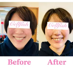 【2週間以内にご予約の方】小顔矯正！頭や顔が 小さくなり“形まで” 変わる！  誰でも頭蓋骨矯正、小顔矯正の効果を実感！