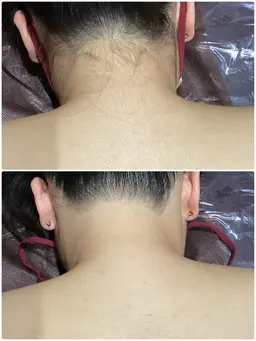 期間限定✨全身(vio込み)➕顔¥15000❣️ご来店前の自己処理不要🫡💕うなじ、手足の甲指も付いてます💗