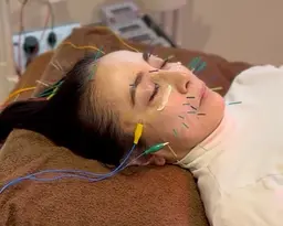 【40​〜​50代人気】大人の美容鍼60分｜巡りケア付き【小顔・女性専用・浦和】ミニモ限定11,000円→5,500円