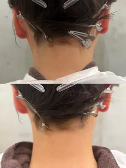 【うなじ脱毛】美容師しかできない襟足デザインカット➕光脱毛⭐️SHR搭載機種🪄最短4ヶ月で理想のうなじに🎀