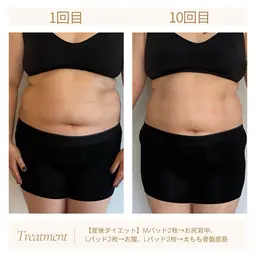 巻いて寝るだけ、脂肪アタック、そして燃焼→インナーマッスルまで鍛えて痩せる、ハイスペックマシーンTMキューブ