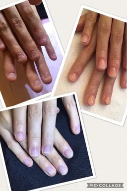 美爪へ変身🩵深爪矯正ネイル(ジェルコート込み)  当店オフ込み¥8800