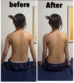 【minimo限定】minimo等掲載可能beforeafterモデル 背中、腕ロミロミ肩甲骨はがし+ドライヘッド30分