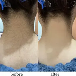 本日&16時まで限定クーポン✨ お顔+ジェリーパックの大人気組み合わせ❣️