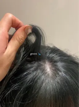 《 12月限定 》ブリーチリタッチ+カラー+プレミアムトリートメント🎀