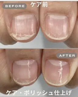 見違えるネイルケアモニター