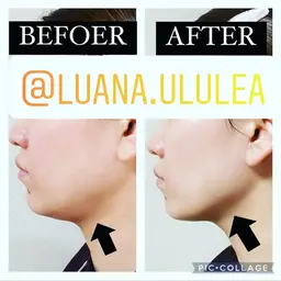 【フェイスライン・リフトUP】 たるみ毛穴引き締め 引き上げコース90分