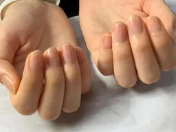 お爪まわりのケア