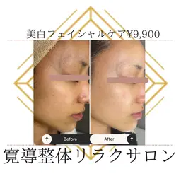 美肌フェイシャルケア😊しわたるみ➕毛穴レス