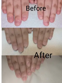 【3ヶ月集中】本気の自爪育成コース ✨39,800