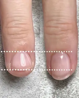 【自爪育成】深爪・ちび爪改善✨