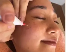 シミケア15分当て放題コース