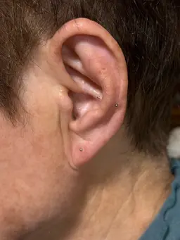 🆕健康＋美容のサポートします！【両耳パーツなしのチタン粒のみで目立たせたくない方にオススメ！】耳ツボジュエリー👂✨