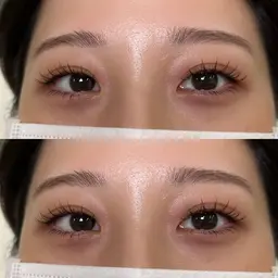 フラットラッシュ100本　(オフ＋500円)