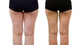 【脚痩せ集中】太ももに強力アプローチ！！