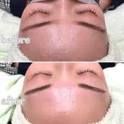 眉ワックス×おでこワックス