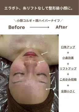 【他サロンにはない珍しいオリジナル】大人気整形級の小顔コルギ！オールハンドで腕、背中、首、顔、頭までしっかりほぐします✨