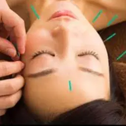 ⭐️ミニモ限定⭐️美容鍼セットコース（美容鍼＋小顔フェイシャル)⭐️5,500円❗️（通常価格より2550円引き）